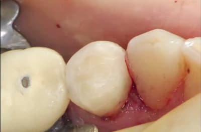 Composite 3 fqrdza - Eugenol