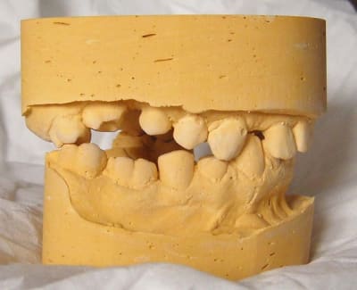Coté droit sprdbx - Eugenol