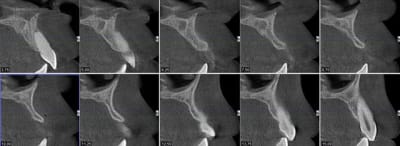 Coupe verticles dv3vle - Eugenol