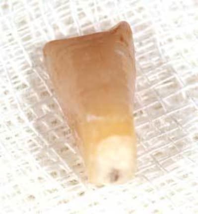 Couronne u6zcgy - Eugenol