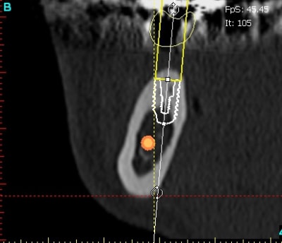 Cr ve cross section d0oqko - Eugenol