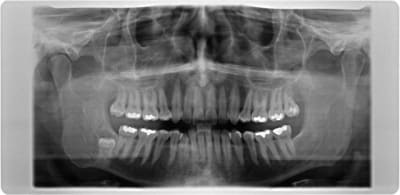Cysta ii g5lzlq - Eugenol