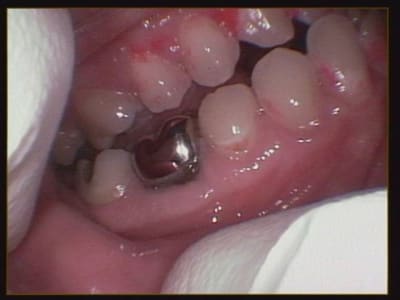 Début cas gc8lni - Eugenol