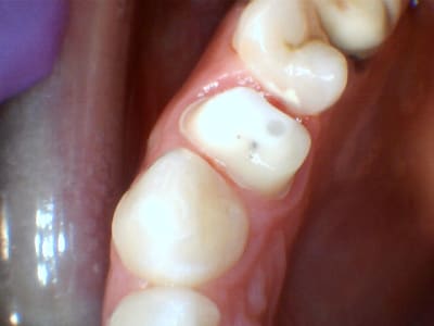 D4sk89jlxmc6onhgrmbq - Eugenol