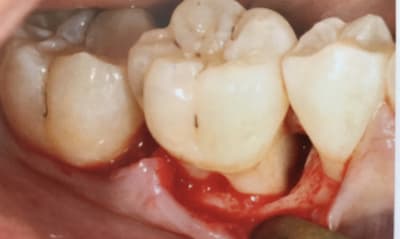 D81mtvc4zhd17sf6tbk8 - Eugenol