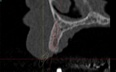 Dar13i aujibg - Eugenol