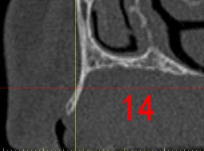 Dar14 ygglyj - Eugenol