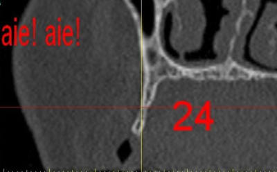 Dar24 ocq9fn - Eugenol