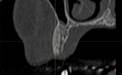 Dar24 vzfroa - Eugenol