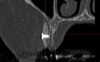 Dar25 lcptyk - Eugenol