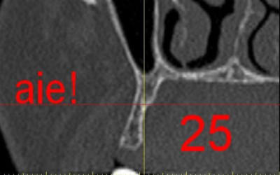 Dar25 spvbmk - Eugenol