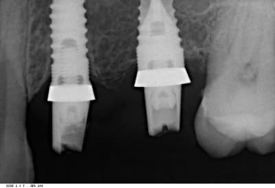 Deboram pariente f 20150121 2298 wzl280 - Eugenol