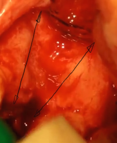 Defaut ant axes uh00s0 - Eugenol