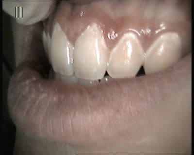 Dem yu7wms - Eugenol