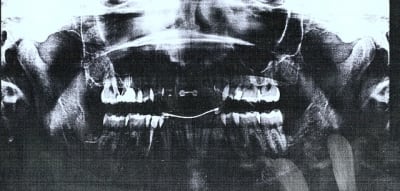 Derniere oarvwf - Eugenol