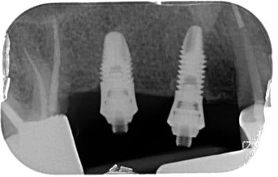 Dkanuecb4nb6vkr3jday - Eugenol