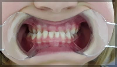 Dl5zgsbgby8ub4vi0qi0ao46dwfr - Eugenol