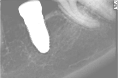 Douieb w3eklx - Eugenol