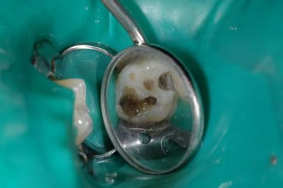 Dsc 2657 x4vox0 - Eugenol