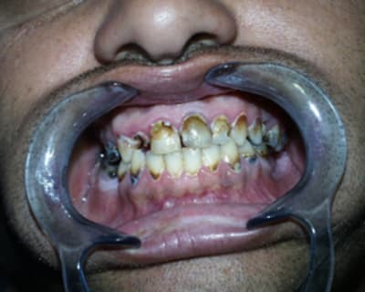 Dvd2 kiqg7z - Eugenol