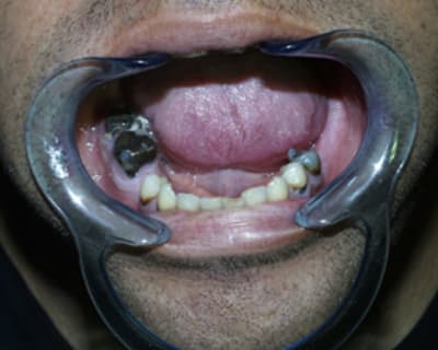 Dvd4 ktt3mu - Eugenol