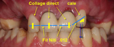 Egression22 v0riwq - Eugenol