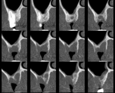 Ehrp 16 kpdjsn - Eugenol
