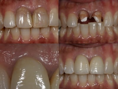 Empress pse4tr - Eugenol