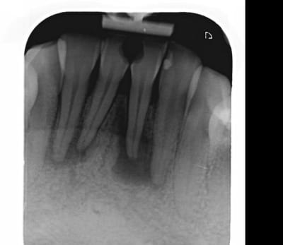 Endo2 vrcjhq - Eugenol