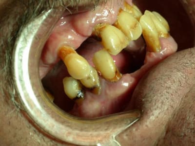 Esq nqo79t - Eugenol