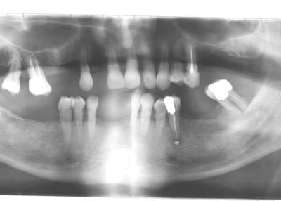 Esq uznylg - Eugenol