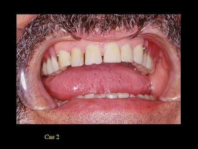 Esthétique4 zembsy - Eugenol