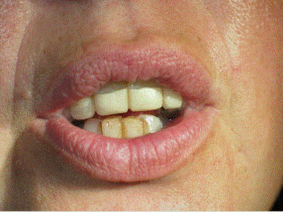 Eug01 phonetic zu37vy - Eugenol