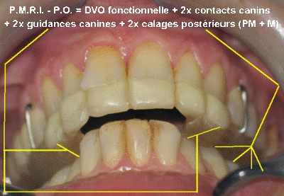 Eug03 pmri po do1n5x - Eugenol