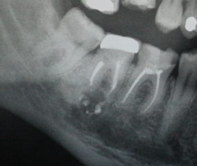 Eugenol ouy2u4 - Eugenol