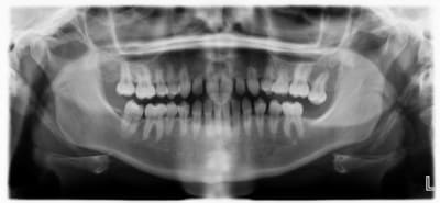 Eugenol xoqze1 - Eugenol