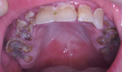 Exemplef puv2si - Eugenol
