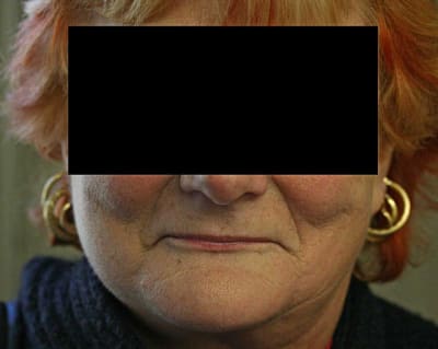 Face actuel vjrx99 - Eugenol