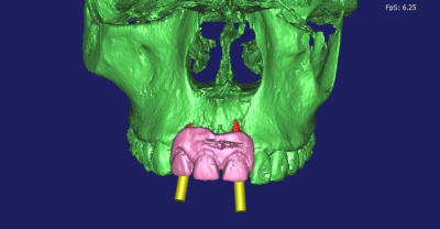 Felicia 3d3 fb1qme - Eugenol