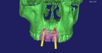 Felicia 3d4 eikcb8 - Eugenol