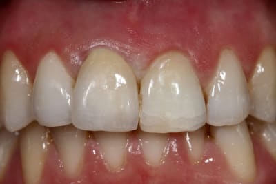 Figure 7 t0x8zk - Eugenol