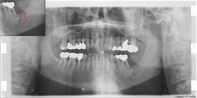 File - Eugenol