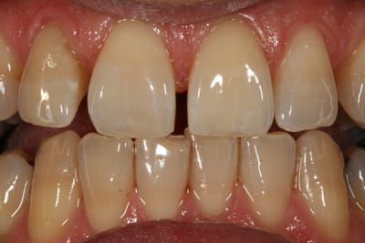 Fin blanc cqgx5k - Eugenol