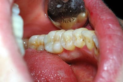 Final mcari9 - Eugenol