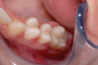 Final xwbw8w - Eugenol
