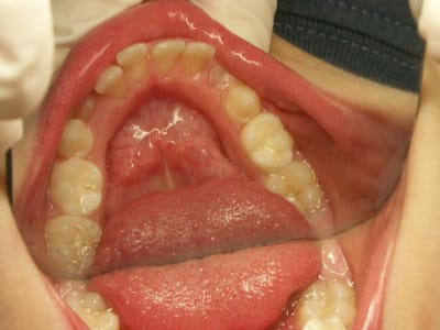 G  9  jpkpka - Eugenol