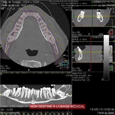 Global cad99b - Eugenol