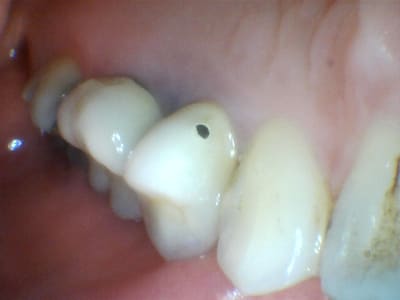 Goup9fax5oynyfqjud8l - Eugenol