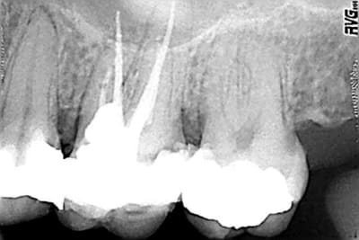 Hall y0vllq - Eugenol