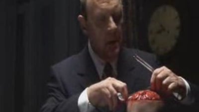 Hannibal mange de la cervelle m8d8y5 - Eugenol